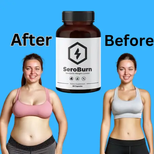 SeroBurn